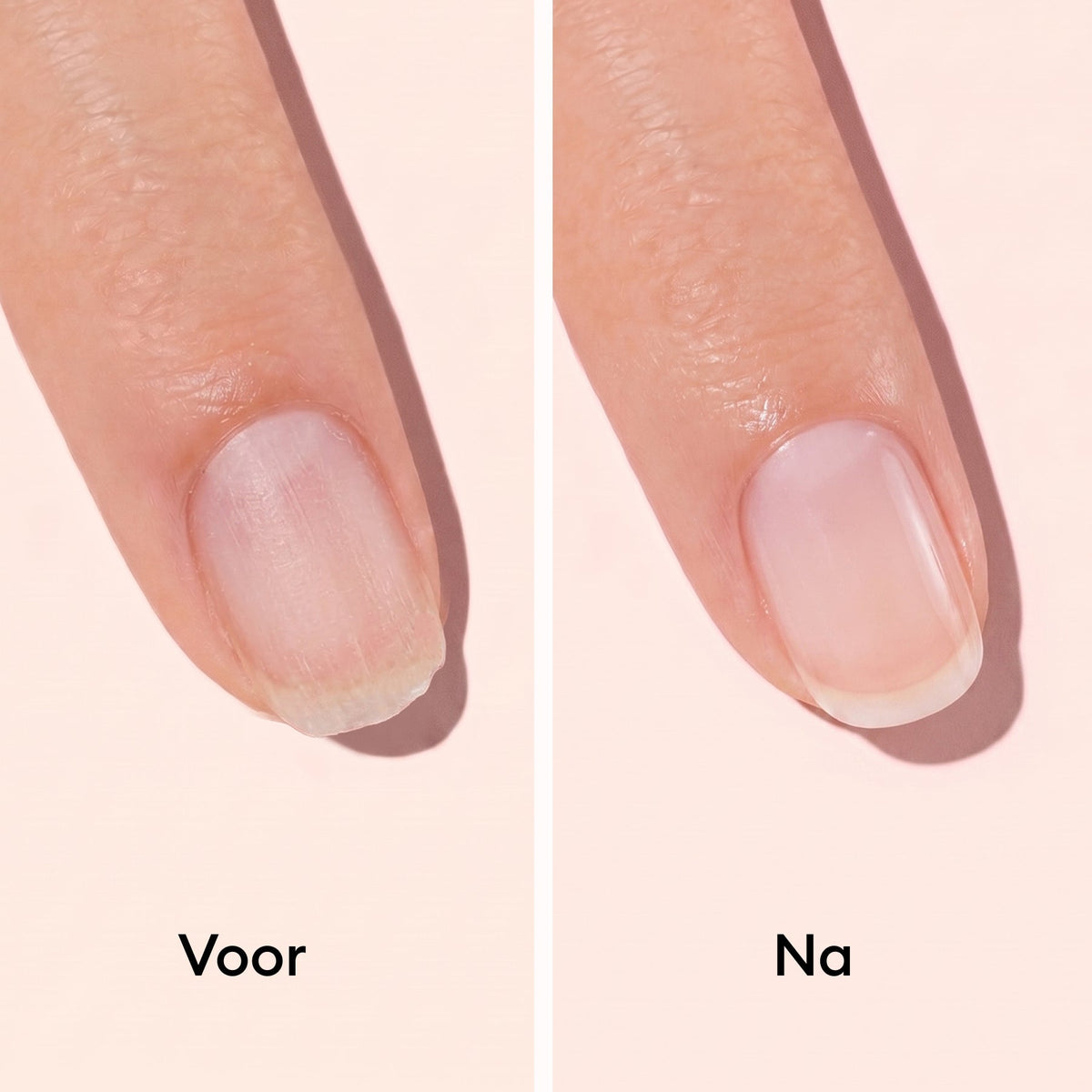 Manucurist Versterkende 3-Stappenkuur  — 1 Set 4stuks inbegrepen