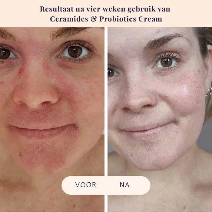 Ceramides & Probiotics Cream - Flow Cosmetics - Ilse de Beaute
