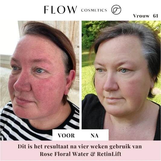 Renewing & Instant Lifting Anti-Aging Cream - Retinlift 3 in 1 Cream (50 ml) - Ilse de Beaute
